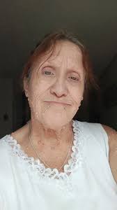 Faces of Neurofibromatosis