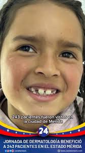 🇻🇪 CASOS DE DENGUE DESCIENDEN UN 66 % EN EL TÁCHIRA 50 casos de dengue se  han registrado en Táchira durante el año 2021, lo que representa un  descenso de 66,7 %