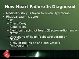Congestive heart failure, or chf, is a condition in which the heart no longer pumps enough blood for the body, causing fluid buildup around these tests help the doctor figure out what caused the heart failure. Drugs Used In Congestive Heart Failure