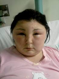 GALERIE: Oběť kosmetiky! Dívka (25) oslepla poté, co si nabarvila vlasy