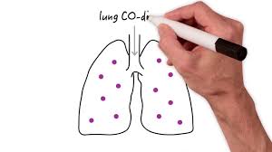 Image result for Diffusing Capacity