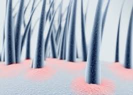 If hair loss that accompanies seborrheic dermatitis can be reversed once a healthy scalp microflora is restored, one could argue that caprylic acid triglycerides may be beneficial in restoring normal hair growth. Seborrheic Dermatitis Hair Loss 2021 Guide Hairguard