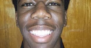 Focus On: Juan Eckard