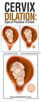Cervix Dilation Signs And Procedure To Dilate Cervix Dilation Cervix Cervix Dilation Chart