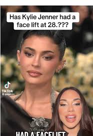 Kylie Jenner's Facelift Rumors Explained at 28