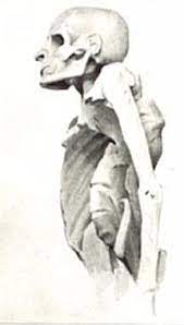 Individuals who make a substantial contribution to a team/event/organisation. Pott Disease Wikipedia