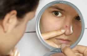 Ramai yang masih tidak mempunyai set asas penjagaan. Jerawat Ada Macam Macam Jenis Punca Tumbuh Jerawat Pun Tak Sama Penting Kena Ambil Tahu Hijabista