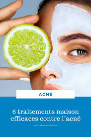 6 Traitements Maison Efficaces Contre L Acne