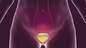 Image result for Overflow Incontinence