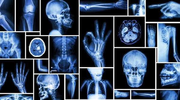 الأشعة السينية ما بين الفوائد والمخاطر - ويب طب