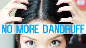 Compound ricinoleic acid found in castor oil promotes circulation to the scalp and induces hair growth. How To Get Rid Of Dandruff With Eggs Egg For Dandruff