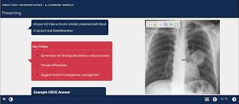 Image result for Chest XRay Interpretation