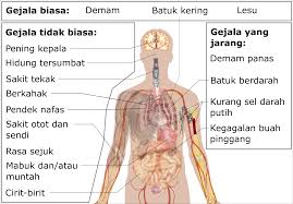 Bagian dari tantangannya adalah bahwa pasien dengan covid yang lama dapat memiliki. Penyakit Koronavirus 2019 Wikipedia Bahasa Melayu Ensiklopedia Bebas
