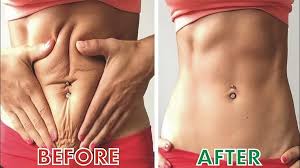 The exfoliating glove with rid skin of dead skin cells and increase circulation to the surface of the skin. How To Get Rid Of Crepey Skin After Pregnancy