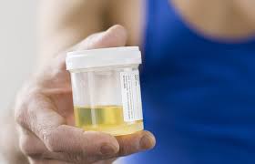 This simple test which is non invasive in nature can be done in any lab and the results can be used not only to detect cervical cancer but also for checking whether you are prone to cervical cancer by looking at the abnormal. Home Cervical Cancer Testing May Replace Pap Tests Women S Health Hospimedica Com