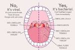 Red Spots On Soft Palate