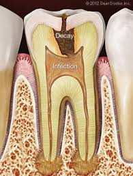 We did not find results for: Tooth Pain Dentist Rocky River Oh Dental Education Library