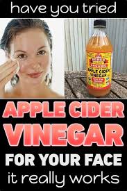 Have You Tried Apple Cider Vinegar For Your Face It Really Works Apple Cider Vinegar For Skin Apple Cider Vinegar Toner Apple Cider Vinegar For Hair