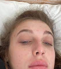 Emma Chamberlain On Instagram Pov Emma Chamberlain Emma Nose Piercing