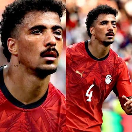 لتكتمل السعادة ولا عزاء للبعض الحزين بإنتصار مصر ❤️ حسام عبدالمجيد بخير..  الأشعة أثبت سلامته وحالته في تحسن مستمر 💪 ألف حمدلله على السلامة يا بطل..  وإن شاء الله تعملوا إنجاز كبير