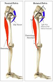 Training To Prevent Hamstring Injuries Tight Hip Flexors Hamstrings Scoliosis Exercises
