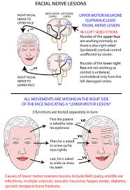 Instant Anatomy Head And Neck Areas Organs Face Facial Nerve Lesions Facial Nerve Medical Knowledge Brain Anatomy
