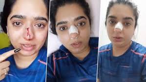 Two days after a bengaluru woman alleged she was attacked by a zomato. 8mzkjaoffziq3m