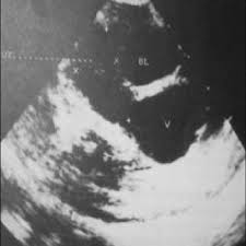 Baby bound was established in february 2012, rachel brady, mom of 4, had a vision and a passion for growing families in her community. Pdf Imaging Of Disorder Of Sex Development