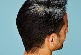 They fall out, then grow back in, and the cycle starts over again. How To Style A Man S Thinning Crown Nioxin