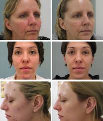 Find great deals on ebay for jan marini skin management. Review Jan Marini Skin Care Management System Skincare Market