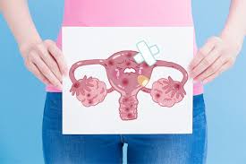 The symptoms of polycystic ovary syndrome (pcos) are a big part of while signs and symptoms of pcos vary in type and severity, the following are the most common ones experienced by women who. Pcos Symptoms Treatment Causes Online Gynecologist Chat