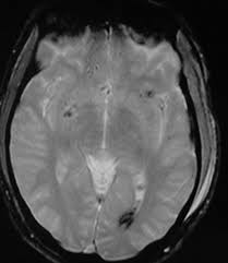 Image result for CT Head