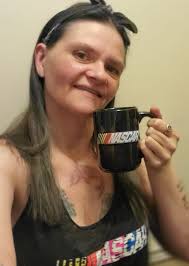 Drinking coffee to battle a migraine