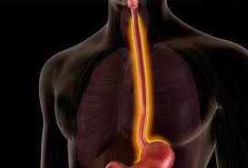 Laryngeal cancer starts in the cells of the larynx (voice box). Esophagitis Diet Causes Symptoms Treatments And Cure