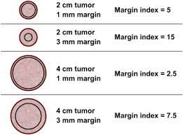 This rim is called a margin. Margin Index A Useful Tool For The Breast Surgeon Sciencedirect