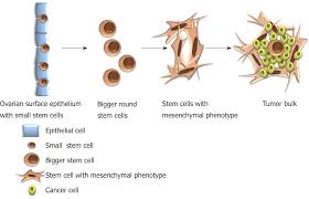 Presence And Role Of Stem Cells In Ovarian Cancer