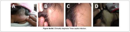 Almond oil considered one of the best powerful natural essential oil used to strengthen hair and stimulate their growth. Almond Oil For Hair Growth Does It Really Help Hairguard