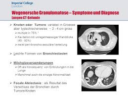 Die Wegener Sche Granulomatose Ppt Herunterladen