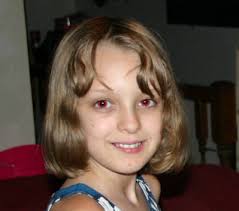 Selain itu, anda juga mungkin mengalami gejala alergi pada hidung, seperti hidung tersumbat dan bersin. Tips Menghindari Mata Merah Saat Dipotret Kakandahariezblackriders