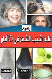 أنواع الشعر وطرق علاجه توعية Blog
