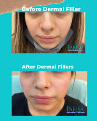 Dr Ashima Goel's Parisa SKIN Cosmetic & LASER Centre