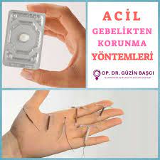 acil gebelikten korunma yontemleri ertesi gun hapi tek doz kullanilan yuvarlak beyaz bir tablettir tablet yumurtlamayi engelleyer iliskiler yumurta gunaydin