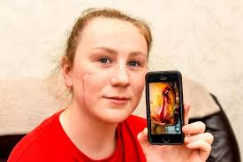 Teenage girl scarred for life after thug launches brutal attack as she  celebrates 17th birthday