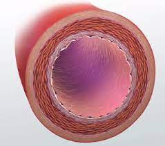 Posted on january 20, 2015 by admin. What Are Arteries Function Definition Biology Class 2021 Video Study Com