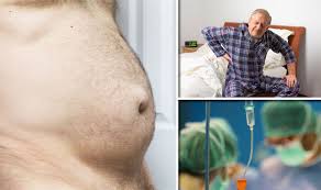Image result for stomach hernia symptoms