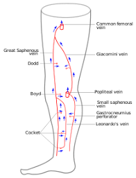 Ultrasonography Of Chronic Venous Insufficiency Of The Legs