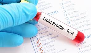 This lipid profile test is also conducted as a follow up to evalute the treatment undergone and diet control programme. What Is The Normal Range Of Lipid Profile Read More