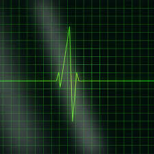 Inima bate cu o frecvenţă între 60 şi 100 de bătăi pe minut. Un Program Pe Calculator Poate Prezice Riscul Batailor Neregulate Ale Inimii Medlife