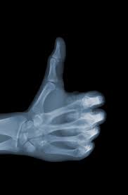 Pin By Pamela Saculles On All In A Day S Work Xray Art X Ray Radiology