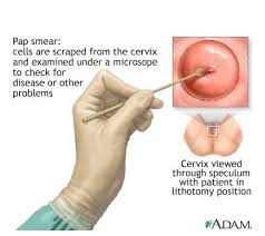 It's important to diagnose and stage cervical cancer early and accurately. The End Of The Pap Test For Cervical Cancer Fox Chase Cancer Center Philadelphia Pa